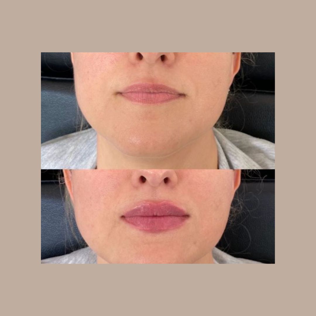 Mónica Hernandez Bulla-12