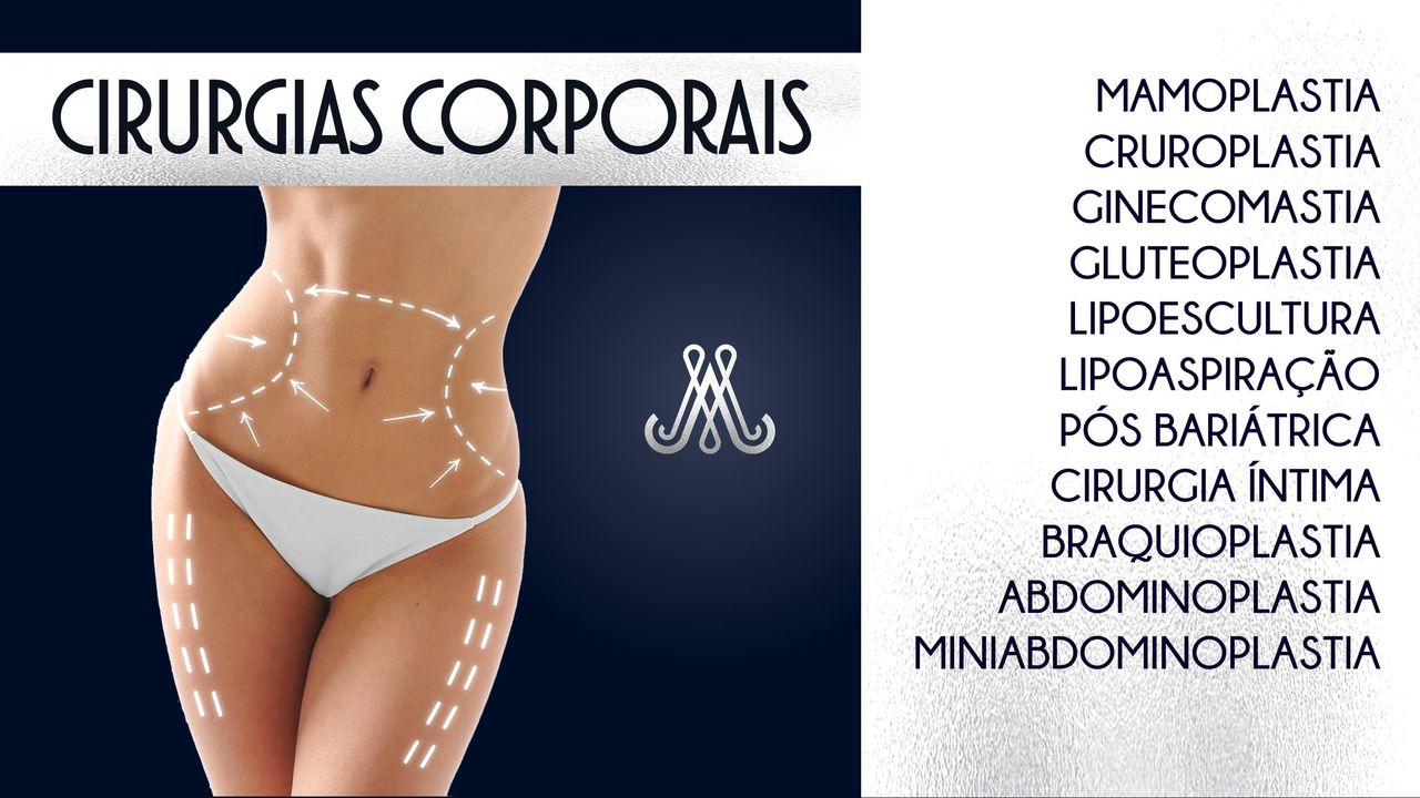 Marco Aurélio Sebben-1