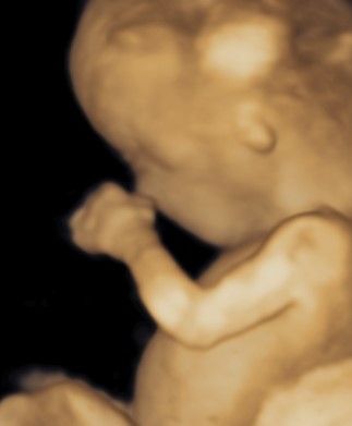 Charles Schwantz De Lima-36