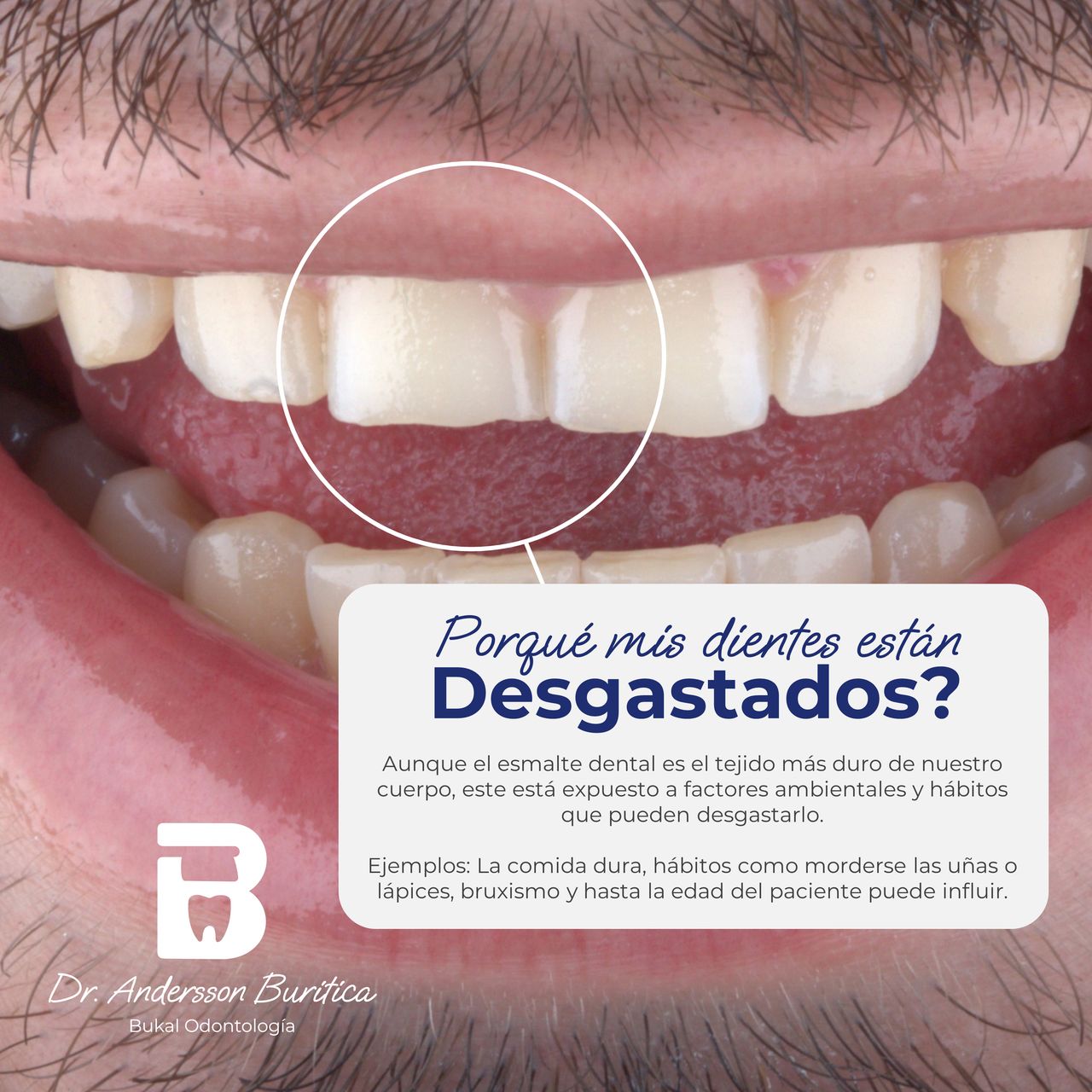 Andersson Buritica-10