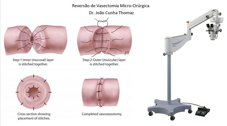 João Cunha Thomaz-8