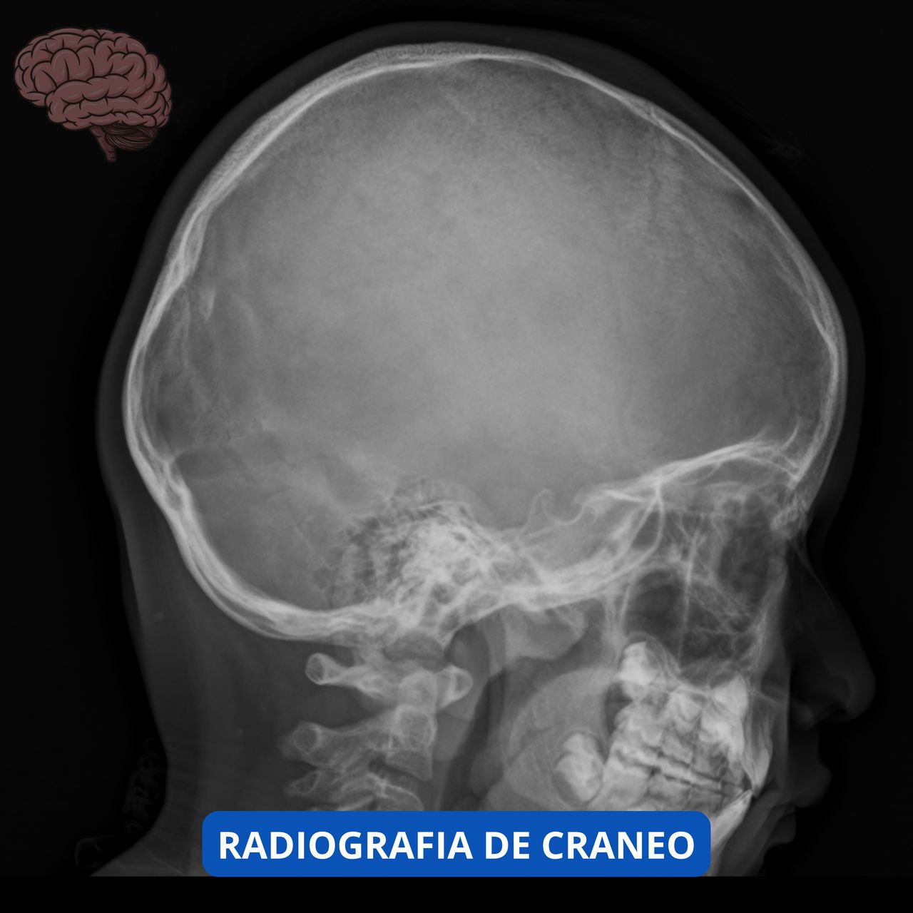 David Tafur Muñoz-1156