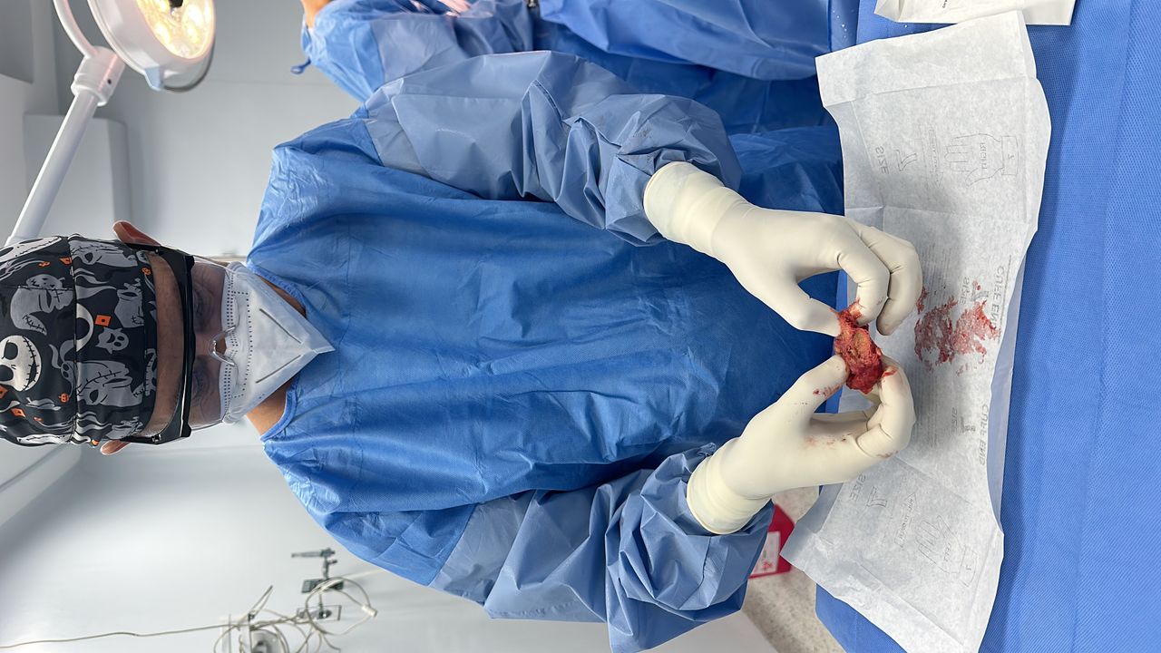 Alexander Alonso Lázaro Chumbe-18