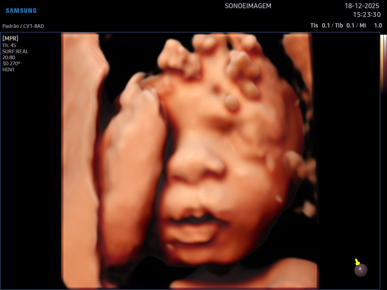 Gontran Tôrres Fróes-0