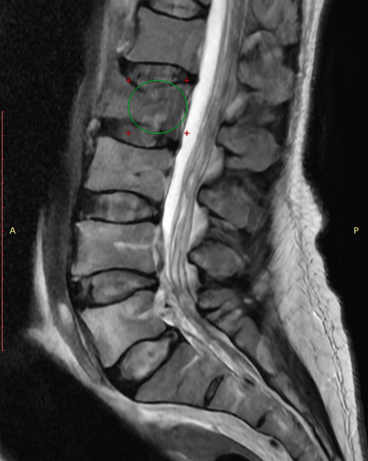 David Tafur Muñoz-2082
