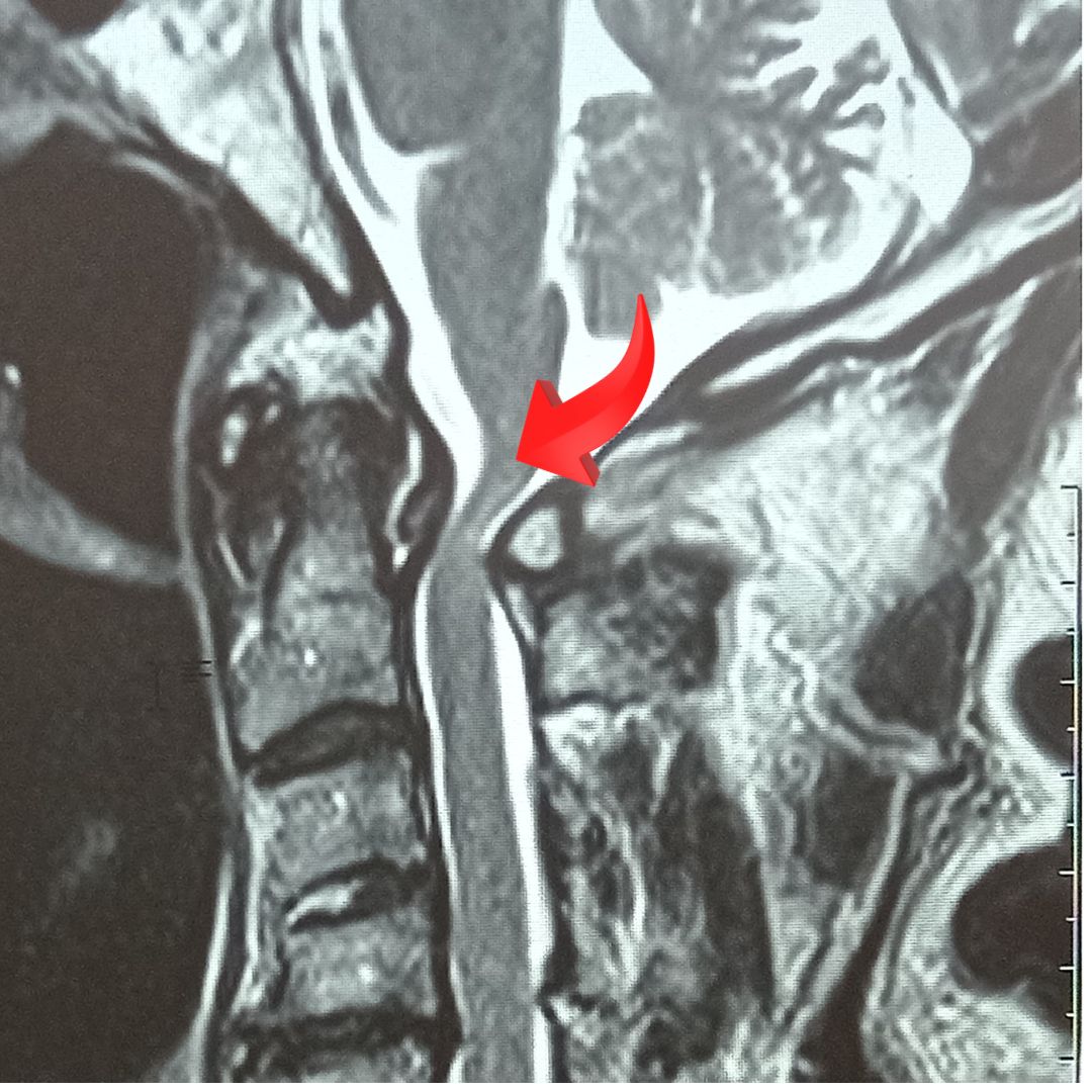 David Tafur Muñoz-2177