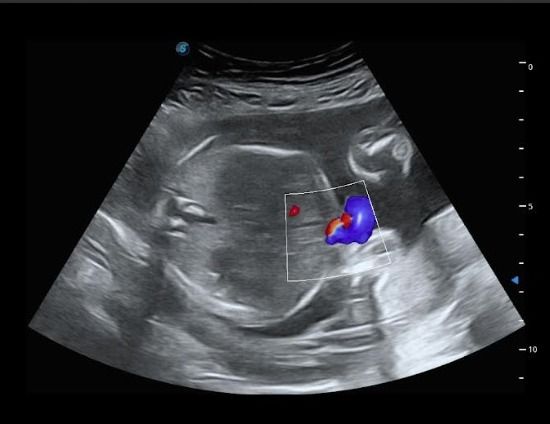 Maite Jesús  Herrera González-3