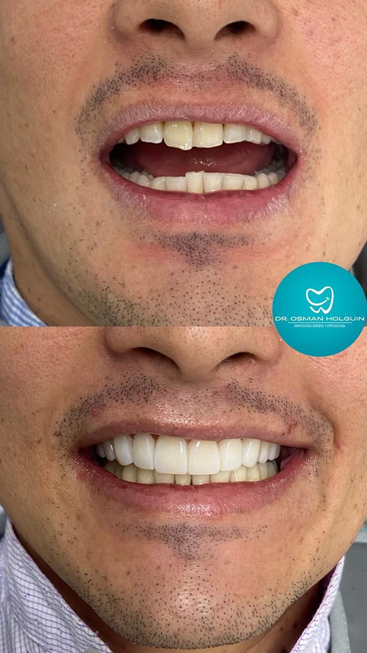 Osman Fernando Holguin Grisales-8