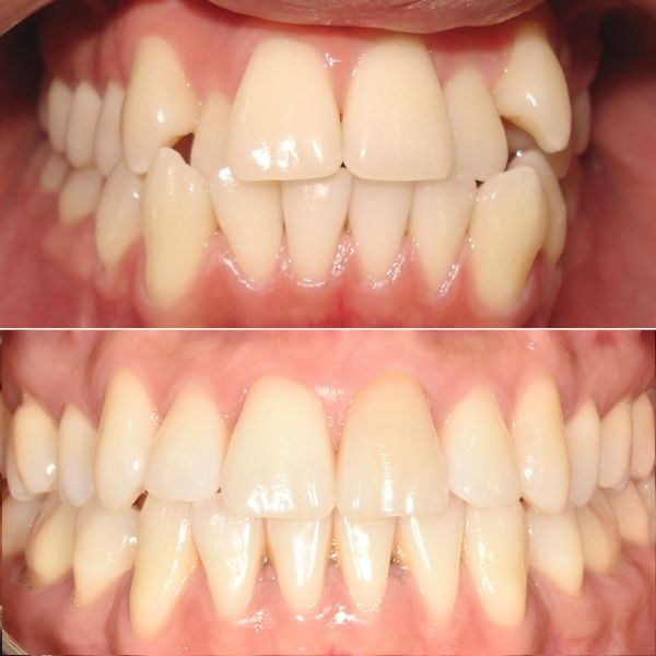 Frank Mendoza Alanya-23