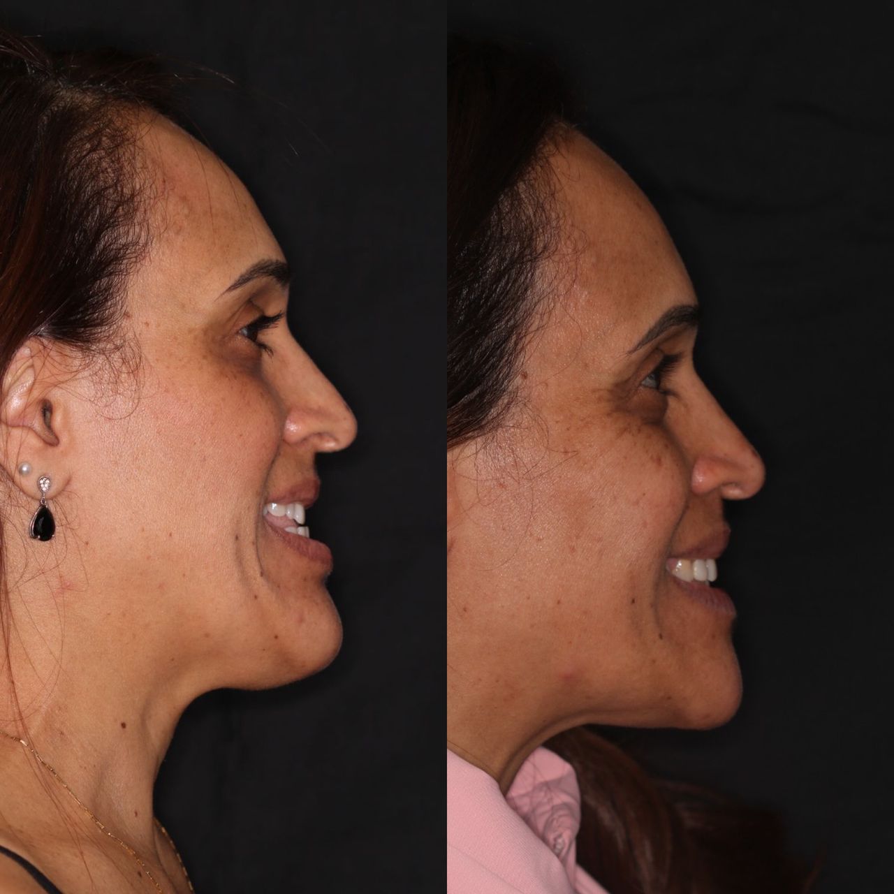 Bruno Nifossi Prado-17