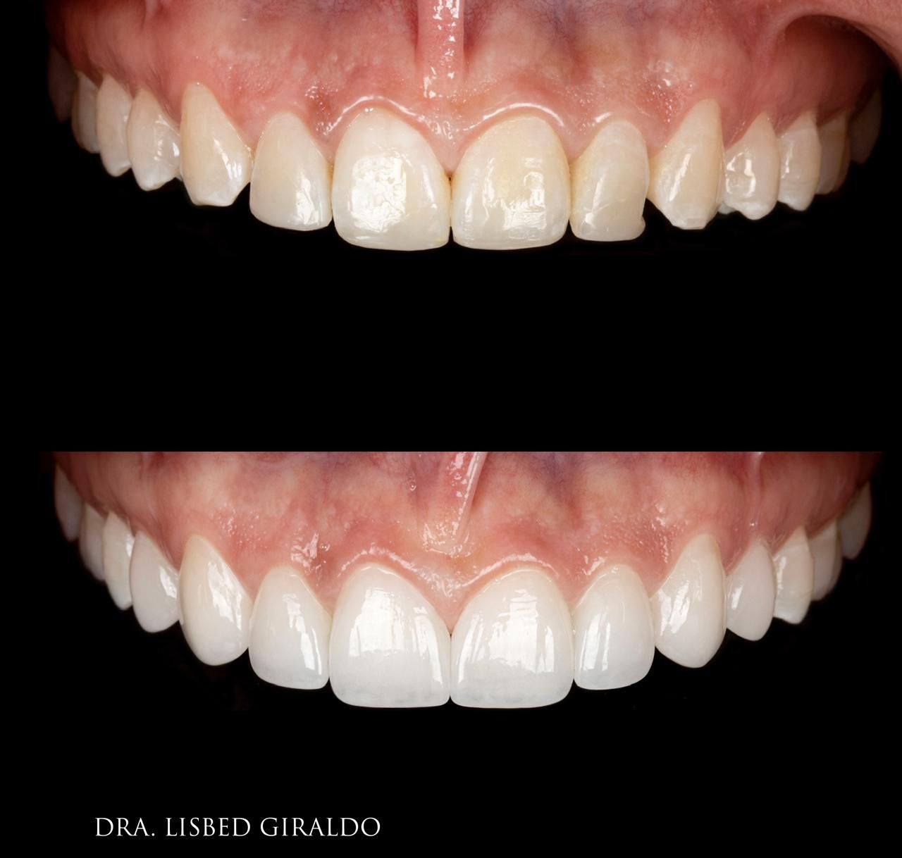 Lisbed Giraldo Olarte-34