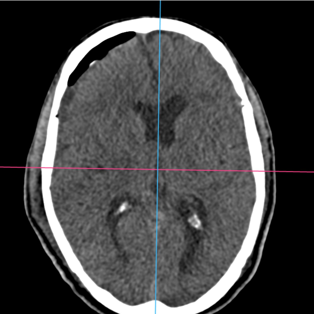 David Tafur Muñoz-1889