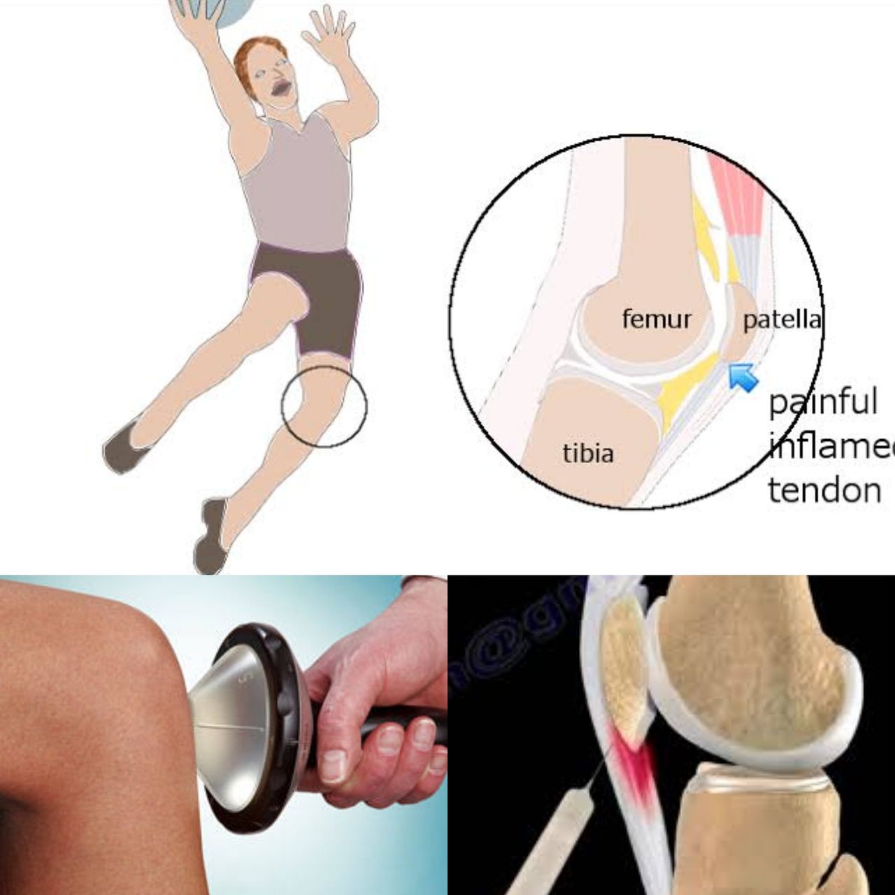 Victor Fontes Pacheco-33