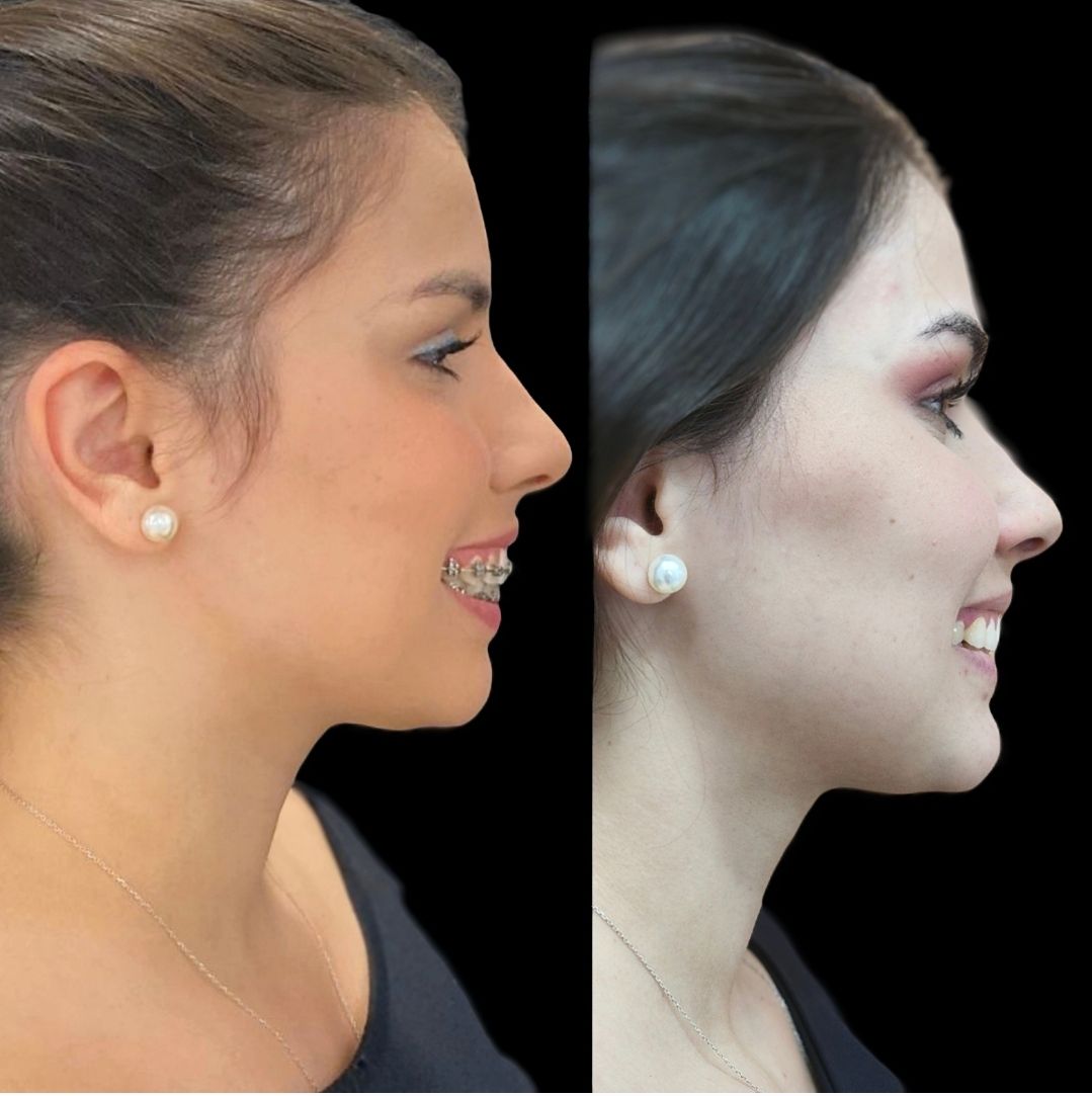 Pedro Henrique Faria Denofrio-4