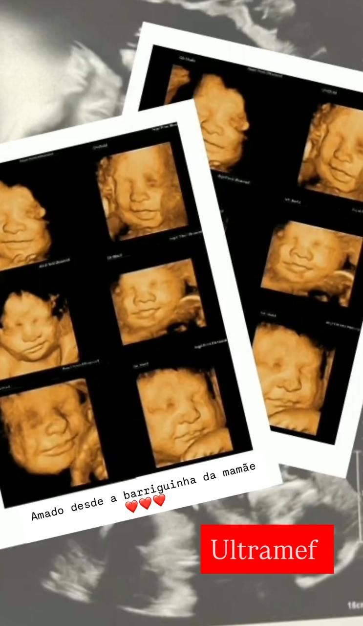 Elson Mário Costa Santos-1