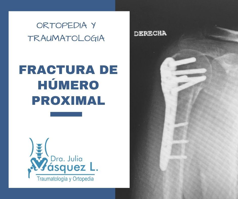 Julia Rosa Vasquez Loyola-4