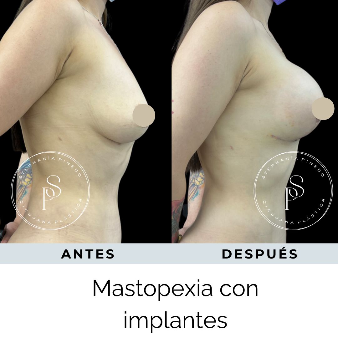 Stephanía Pinedo García-18