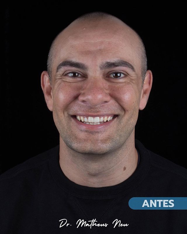 Matheus Da Silveira Neu-6