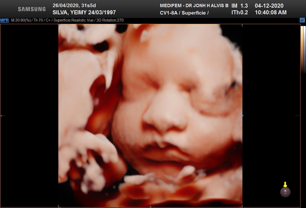 Jonh Harold Alvis Botello-12