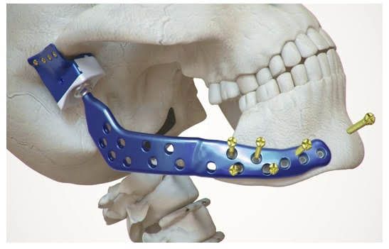 Denis Pimenta E Souza-33