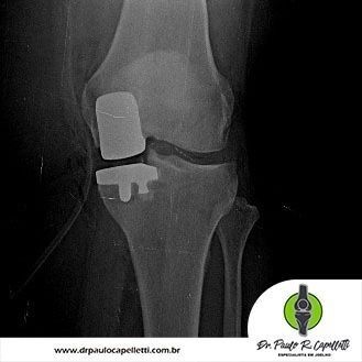 Paulo Roberto Capelletti-32