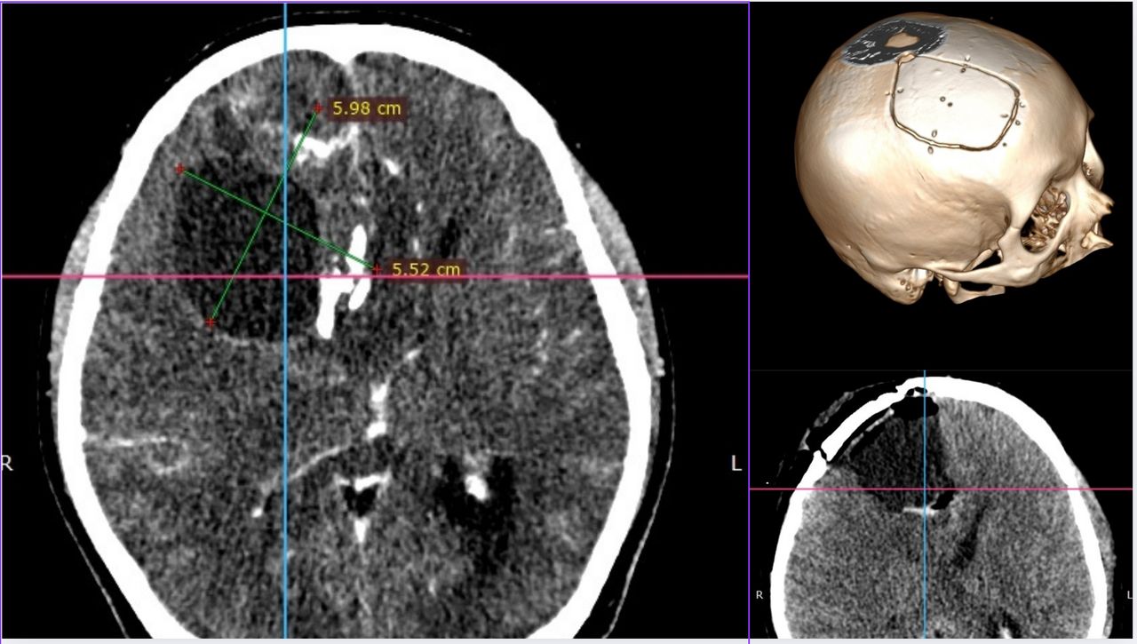 David Tafur Muñoz-2073