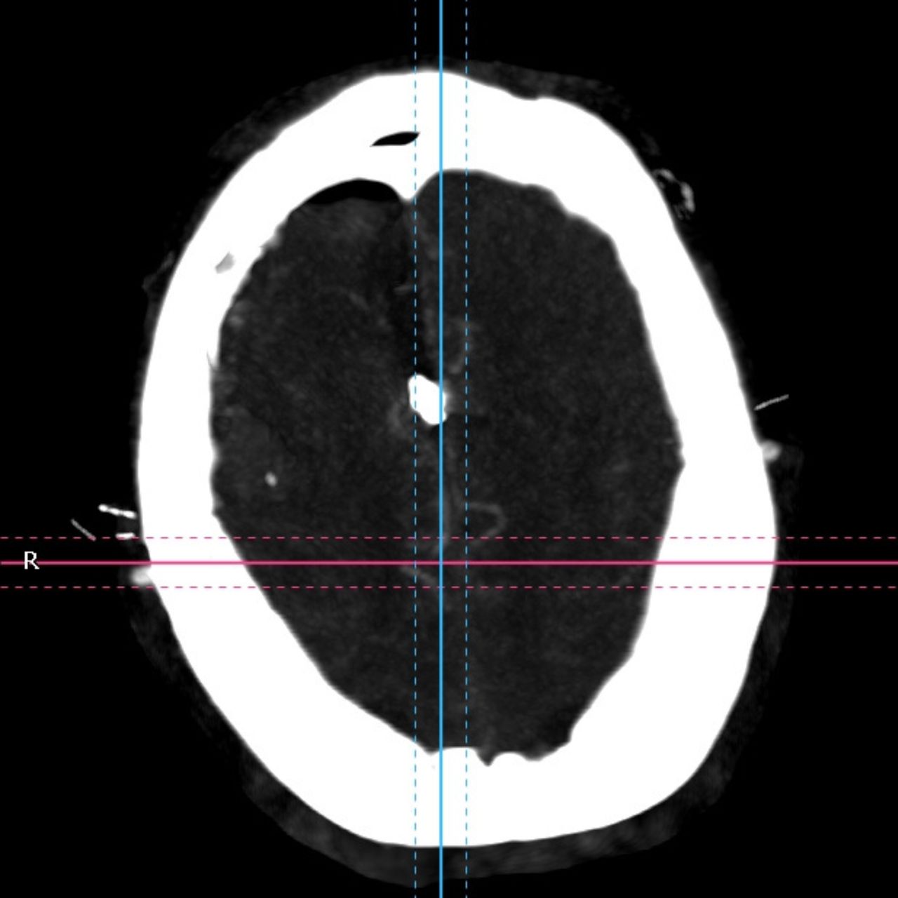 David Tafur Muñoz-1857