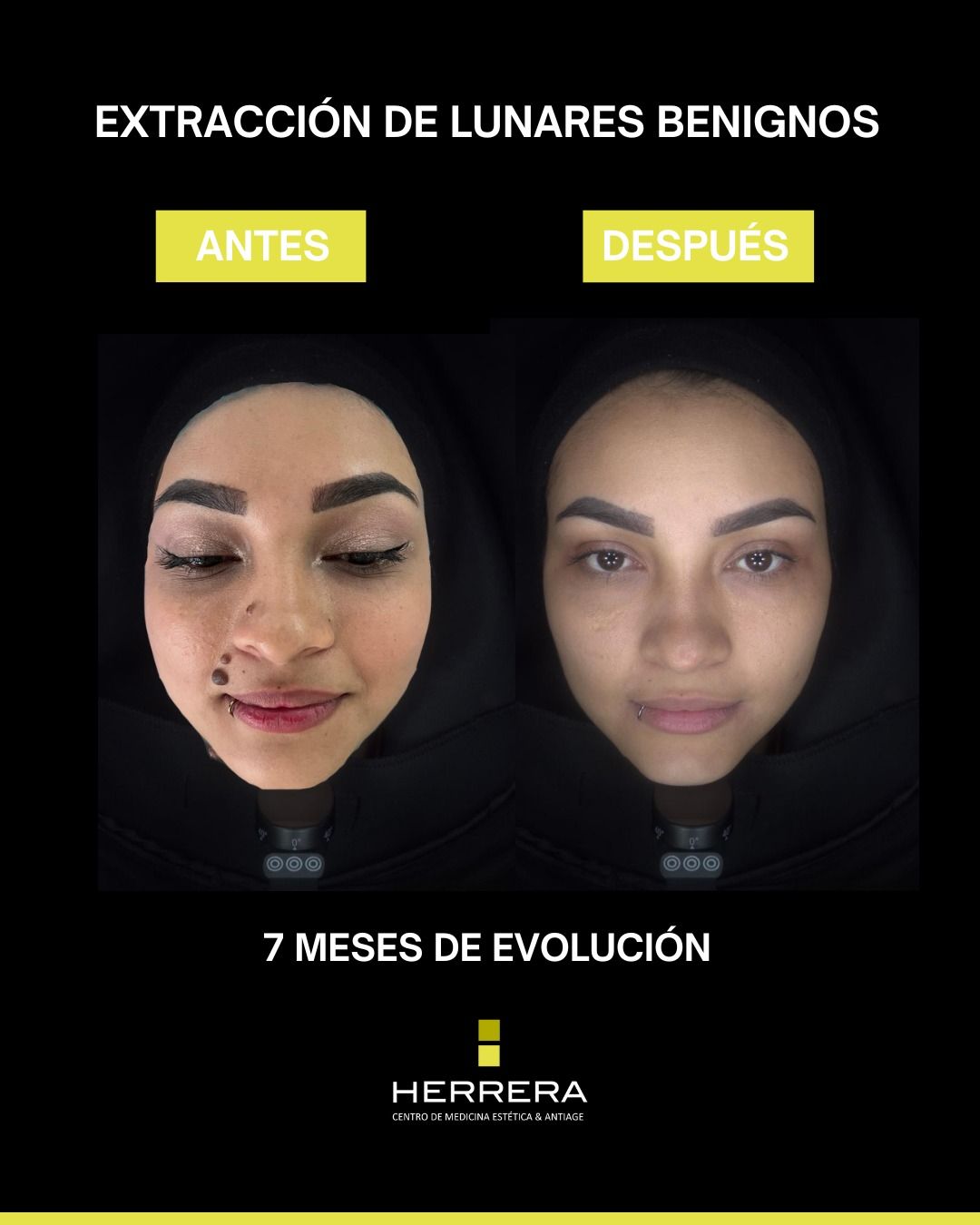 Andrea Alonso Herrera-17