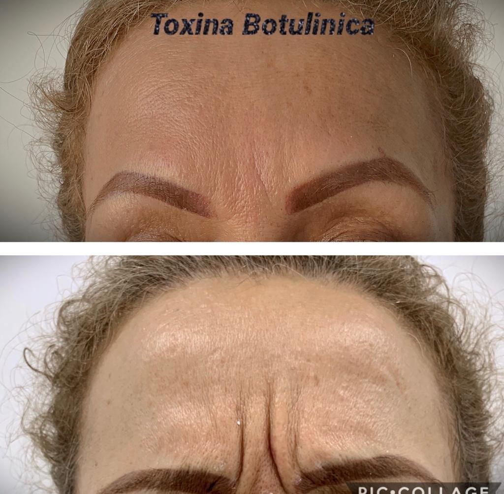 Maria Gisela Angel Losada-84