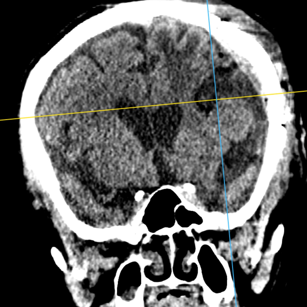 David Tafur Muñoz-1489