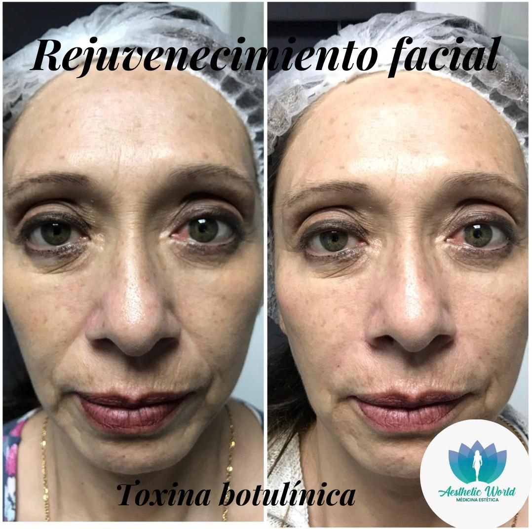 Jhonatan Oyola Farfán-14