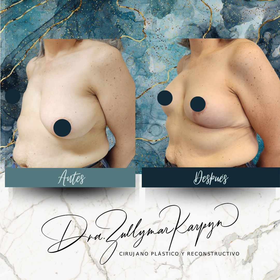 Zullymar Karpyn Brito-18