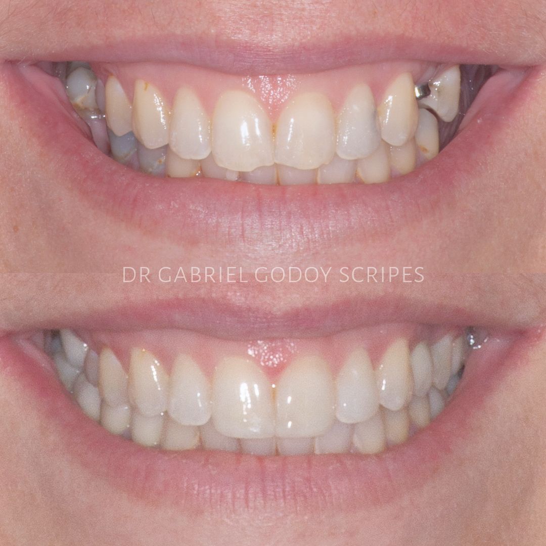 Gabriel Godoy Scripes-15