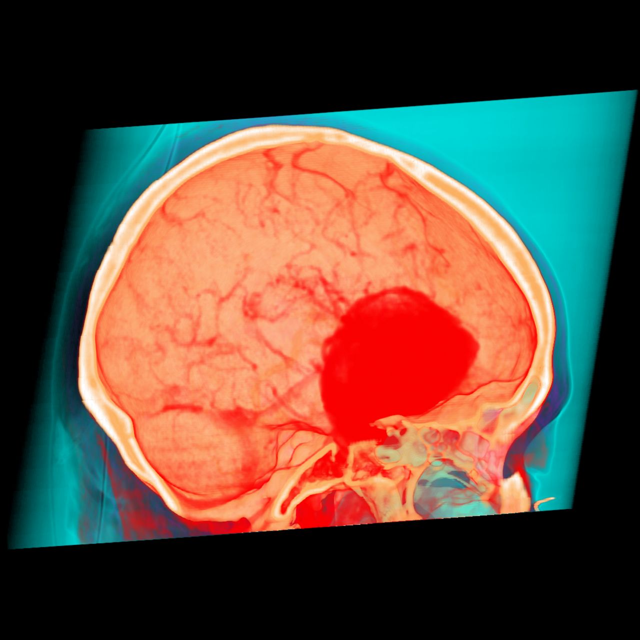 David Tafur Muñoz-1249