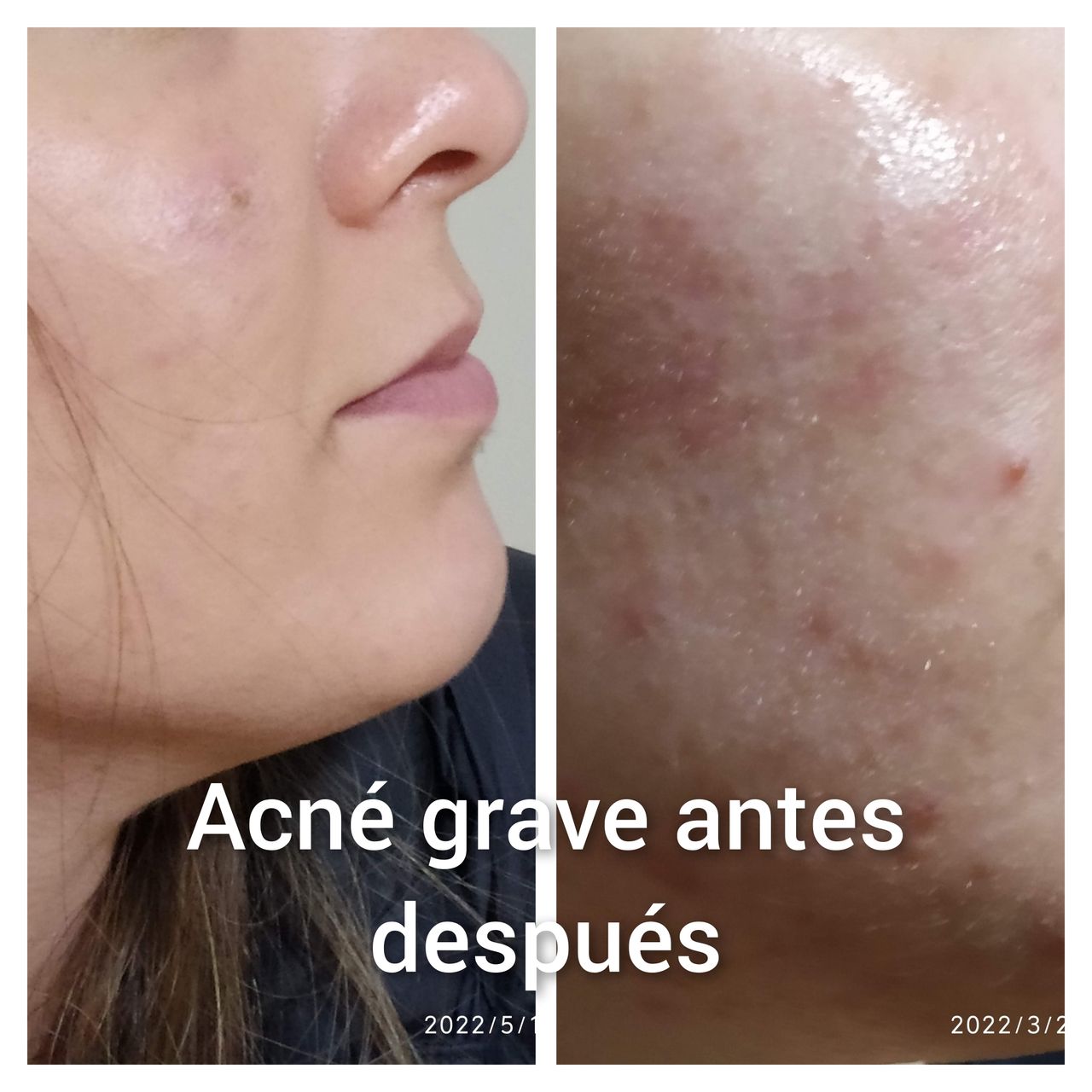 Alejandra Meijide-18