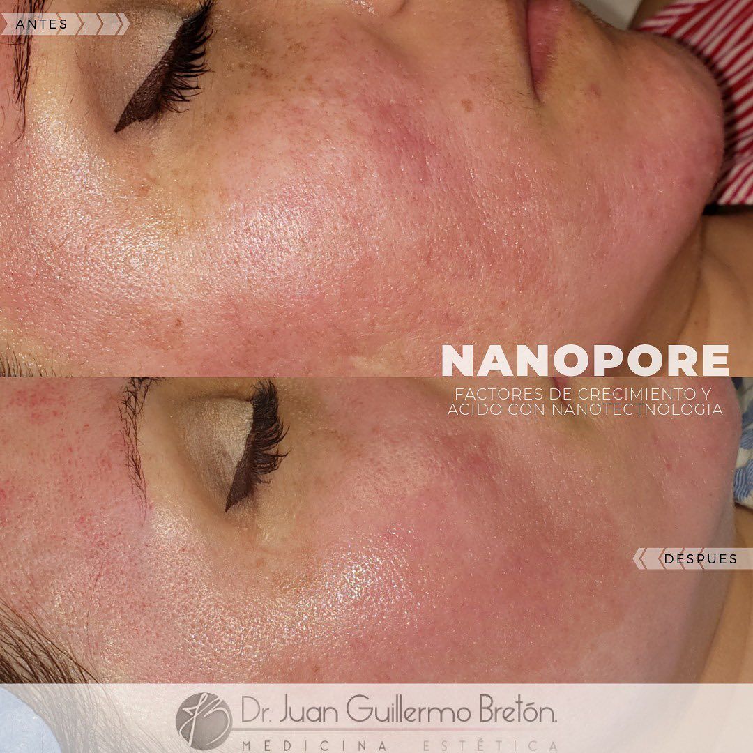 Juan Guillermo Bretón Franco-10