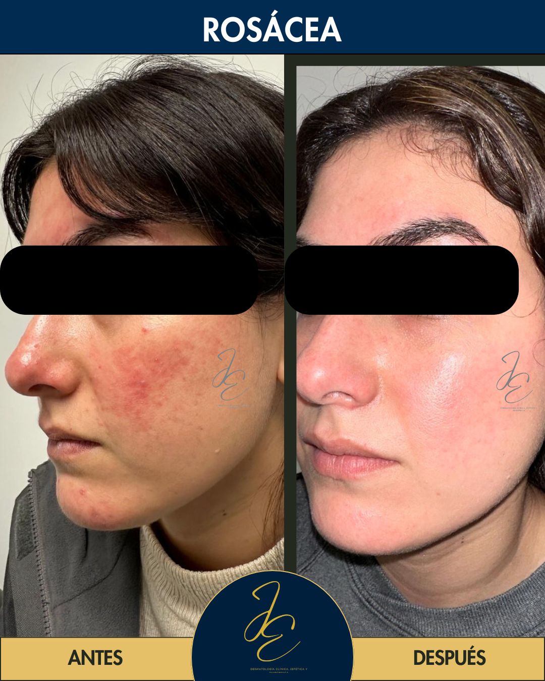 Jeanny Epieyu Diaz-11