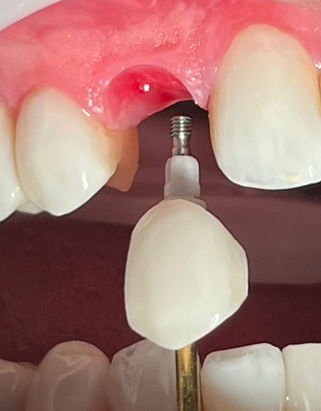 Lidiane Morais Mendes-38