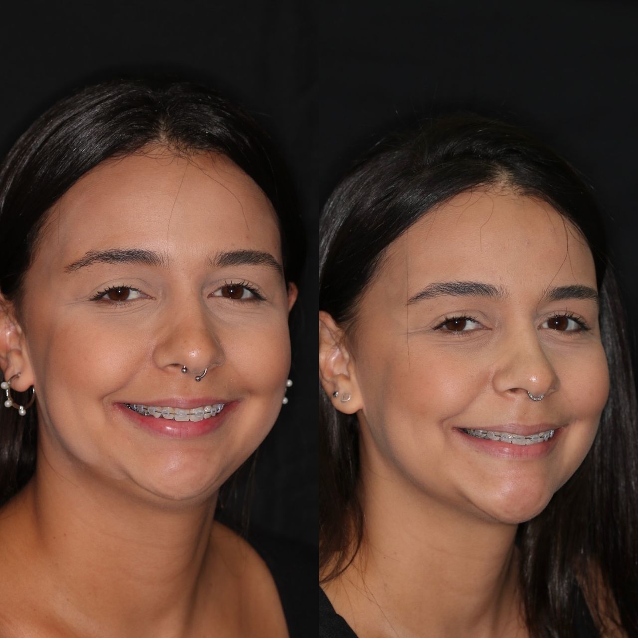 Bruno Nifossi Prado-18