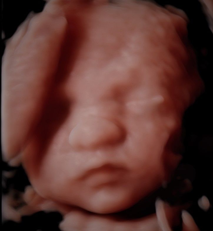 Charles Schwantz De Lima-15