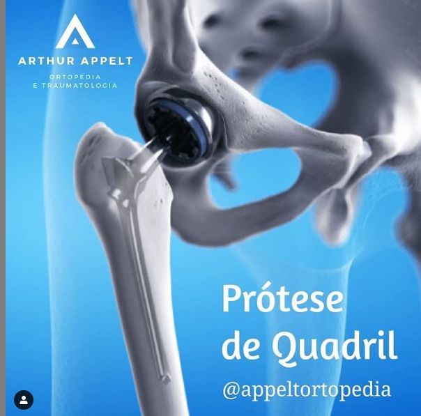 Arthur Lanna Appelt-23