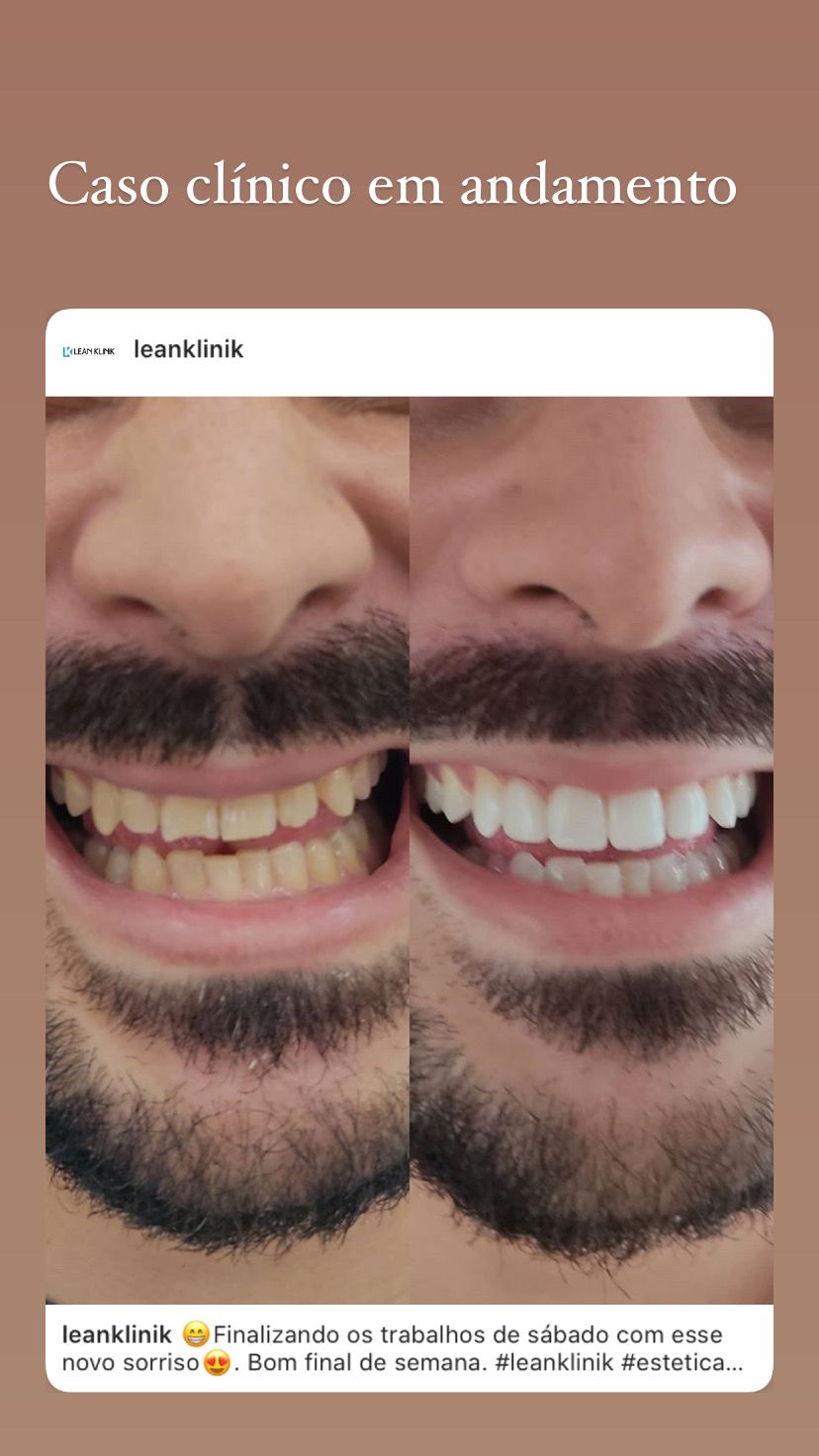 Nayara Fraga De Miranda-20