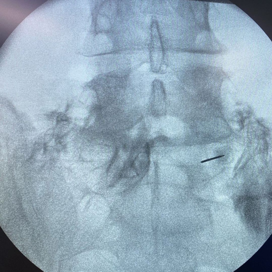 David Tafur Muñoz-2150