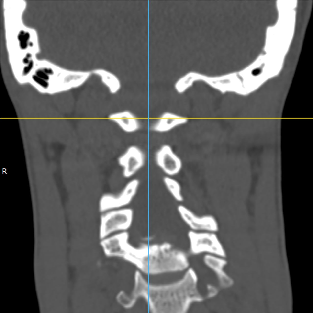 David Tafur Muñoz-2179