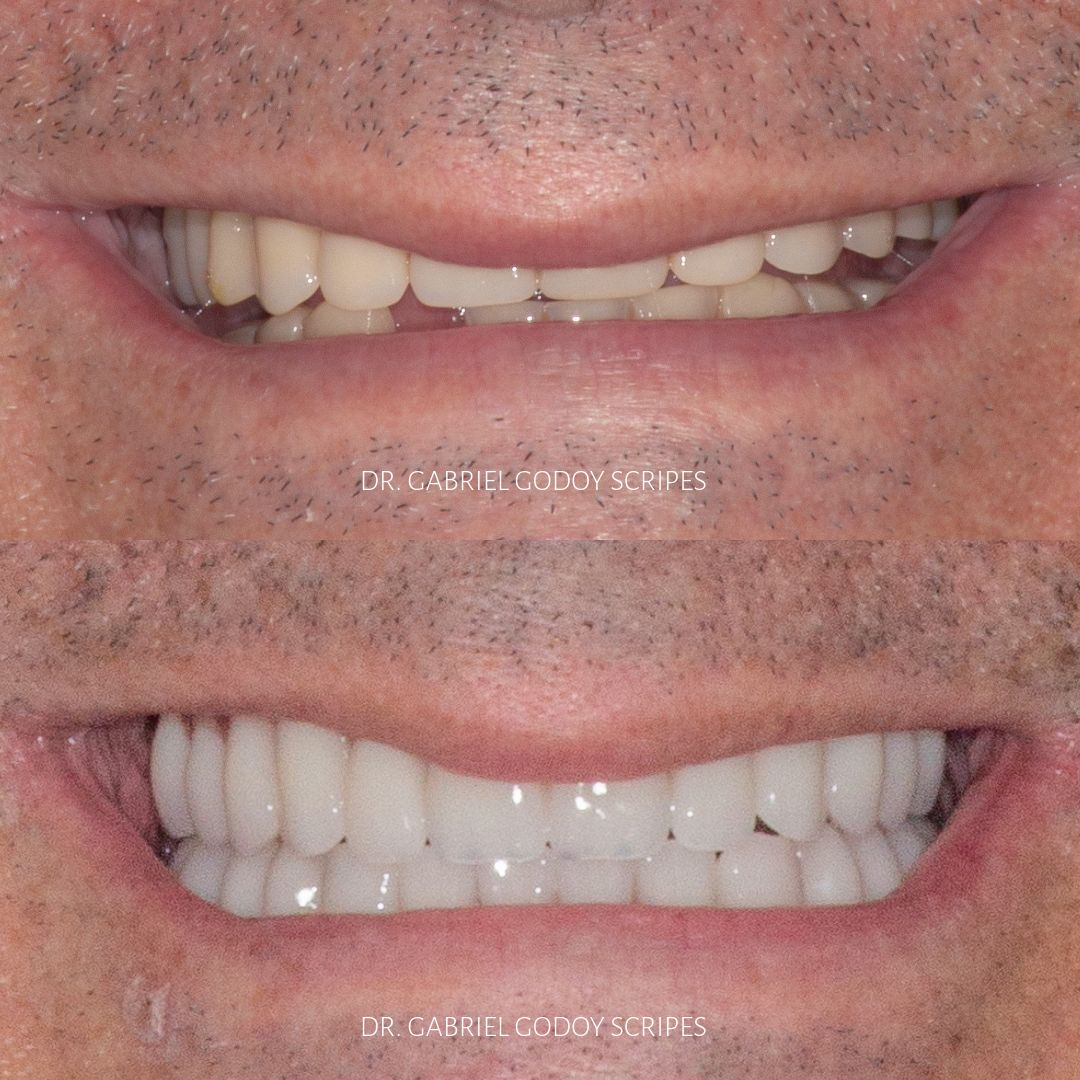 Gabriel Godoy Scripes-17