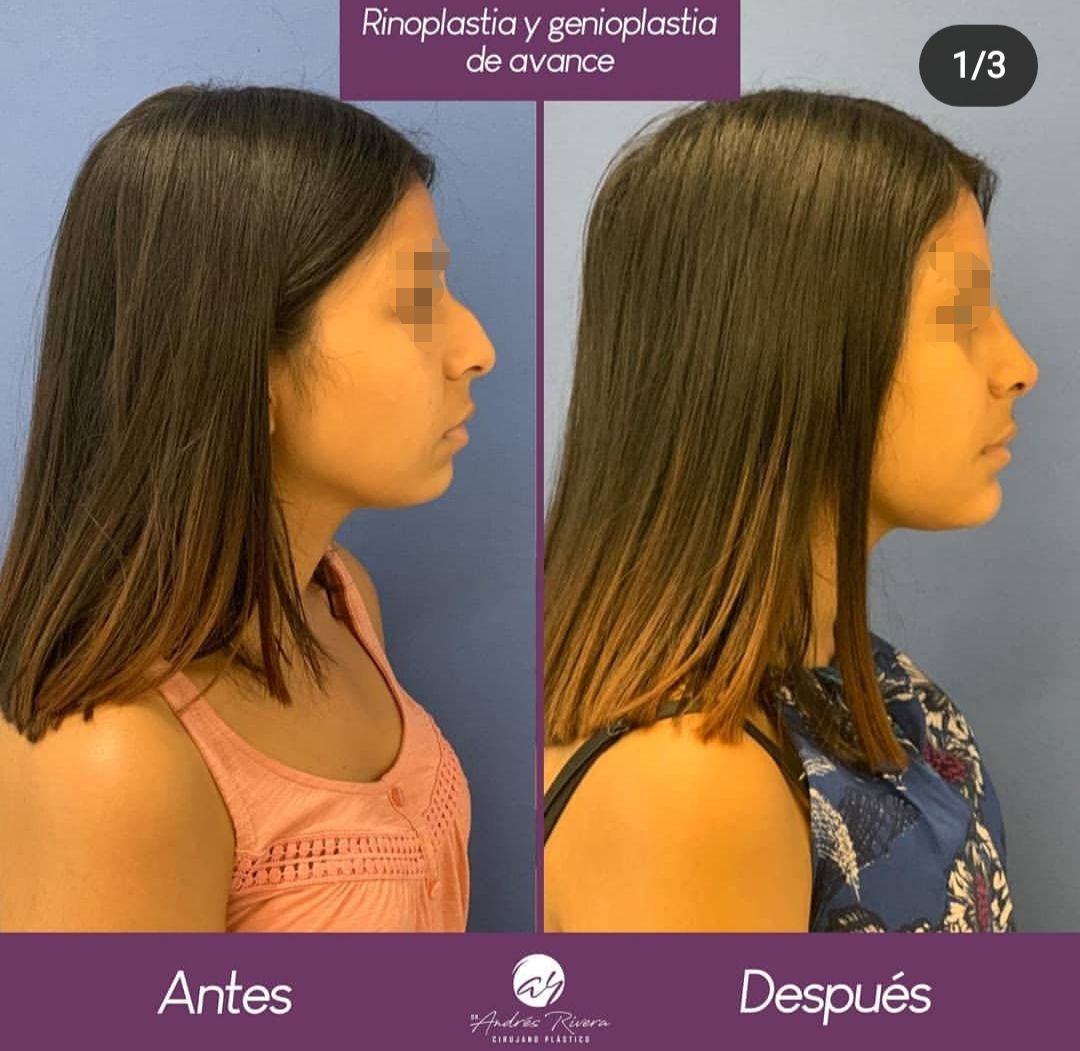 Andrés Rivera López-38