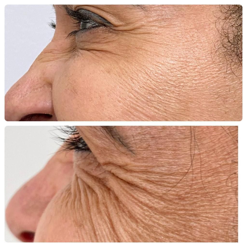 Luiz Antonio Da Silva-15