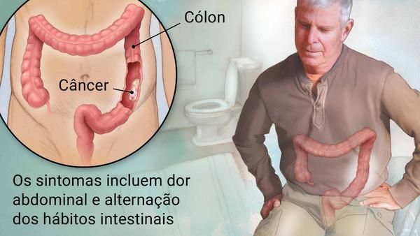 Alan Cézar Faria Araújo-5