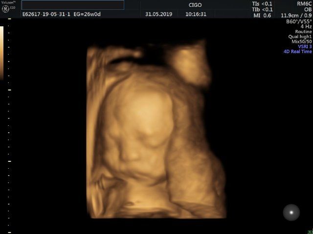 Raul Javier Banderas Pumarino-24