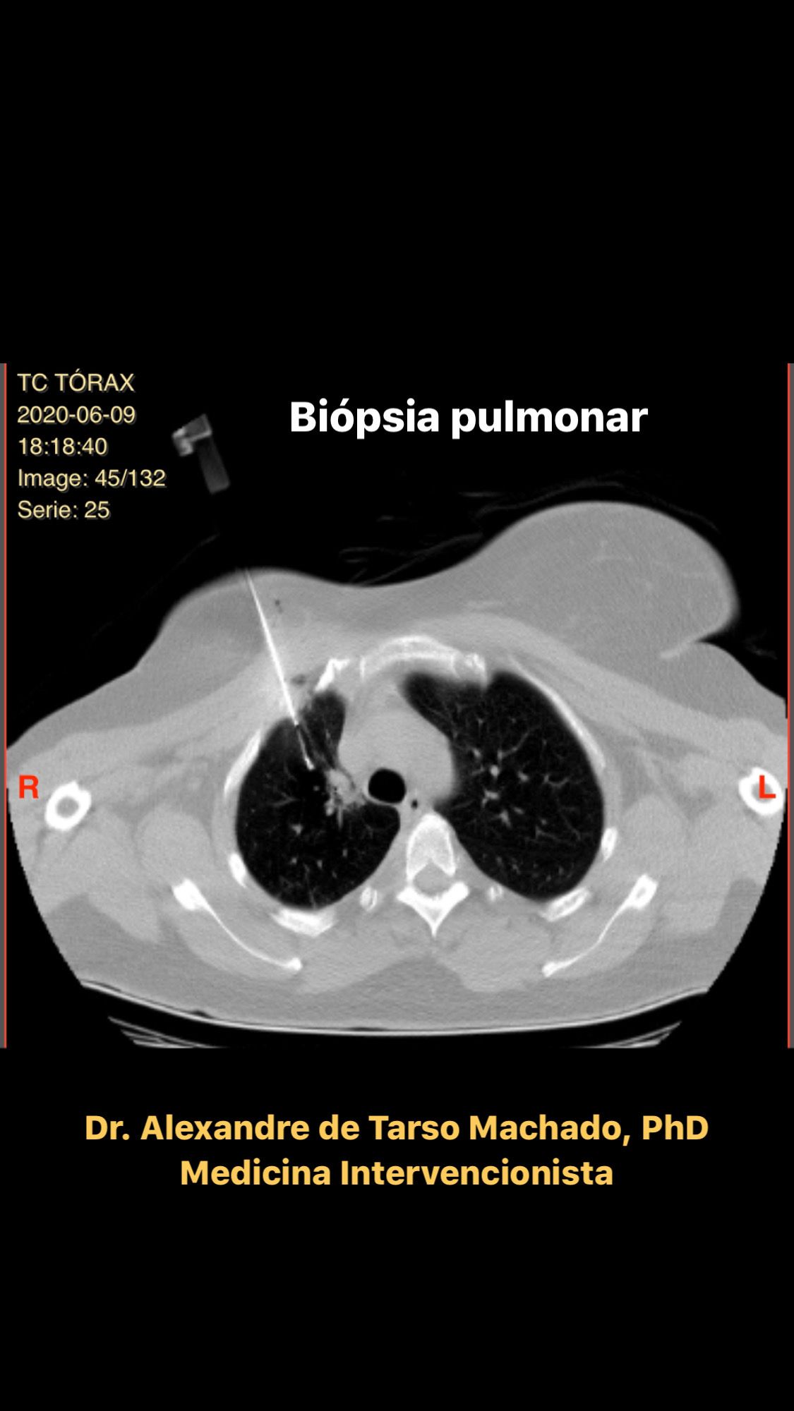 Alexandre De Tarso Machado-6